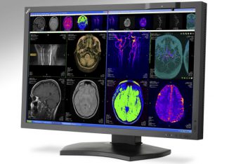 NEC MDview272 e MD302C4, display per la refertazione medica