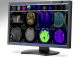 NEC MDview272 e MD302C4, display per la refertazione medica