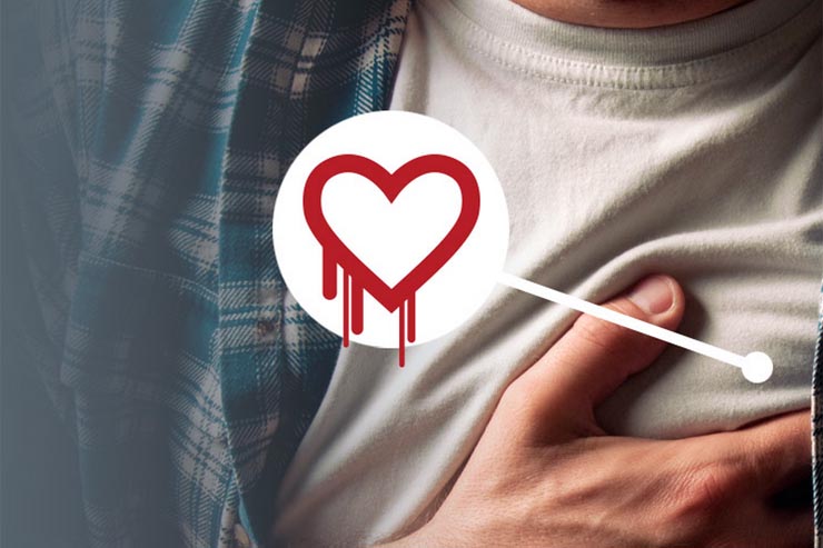 F5 Networks, come difendersi dal bug Heartbleed F5 Networks, come difendersi dal bug Heartbleed